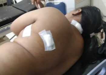 Seorang Guru Madrasah di Tegal Jadi Korban Pembacokan Gegara Obat Warung Aceh