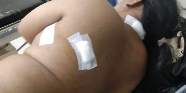 Seorang Guru Madrasah di Tegal Jadi Korban Pembacokan Gegara Obat Warung Aceh